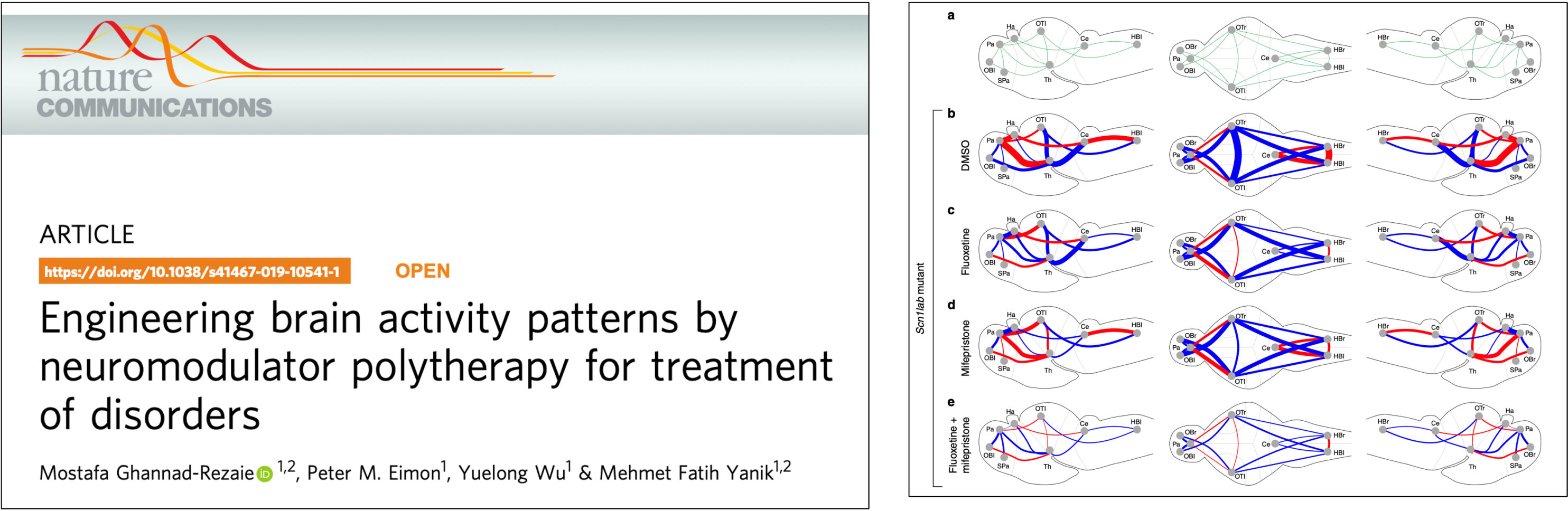 brain activity patterns